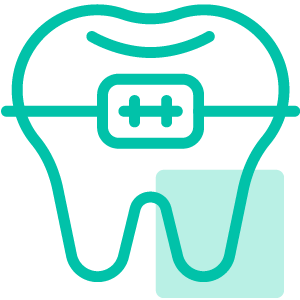 Implantes Dentários